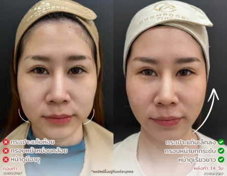 คลินิกผิวหนังใกล้ฉัน
