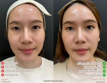 คลินิกผิวหนังใกล้ฉัน