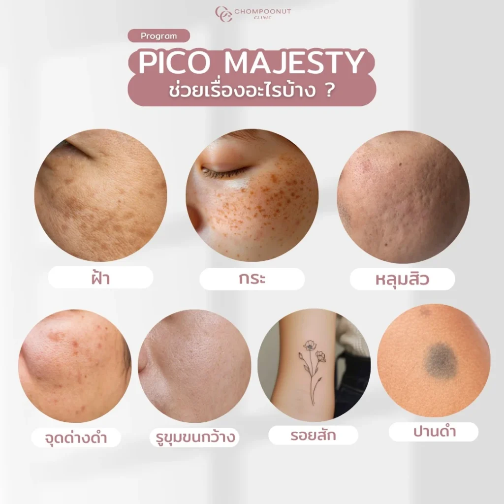 Pico Majesty แก้ปัญหาอะไรได้บ้าง?​