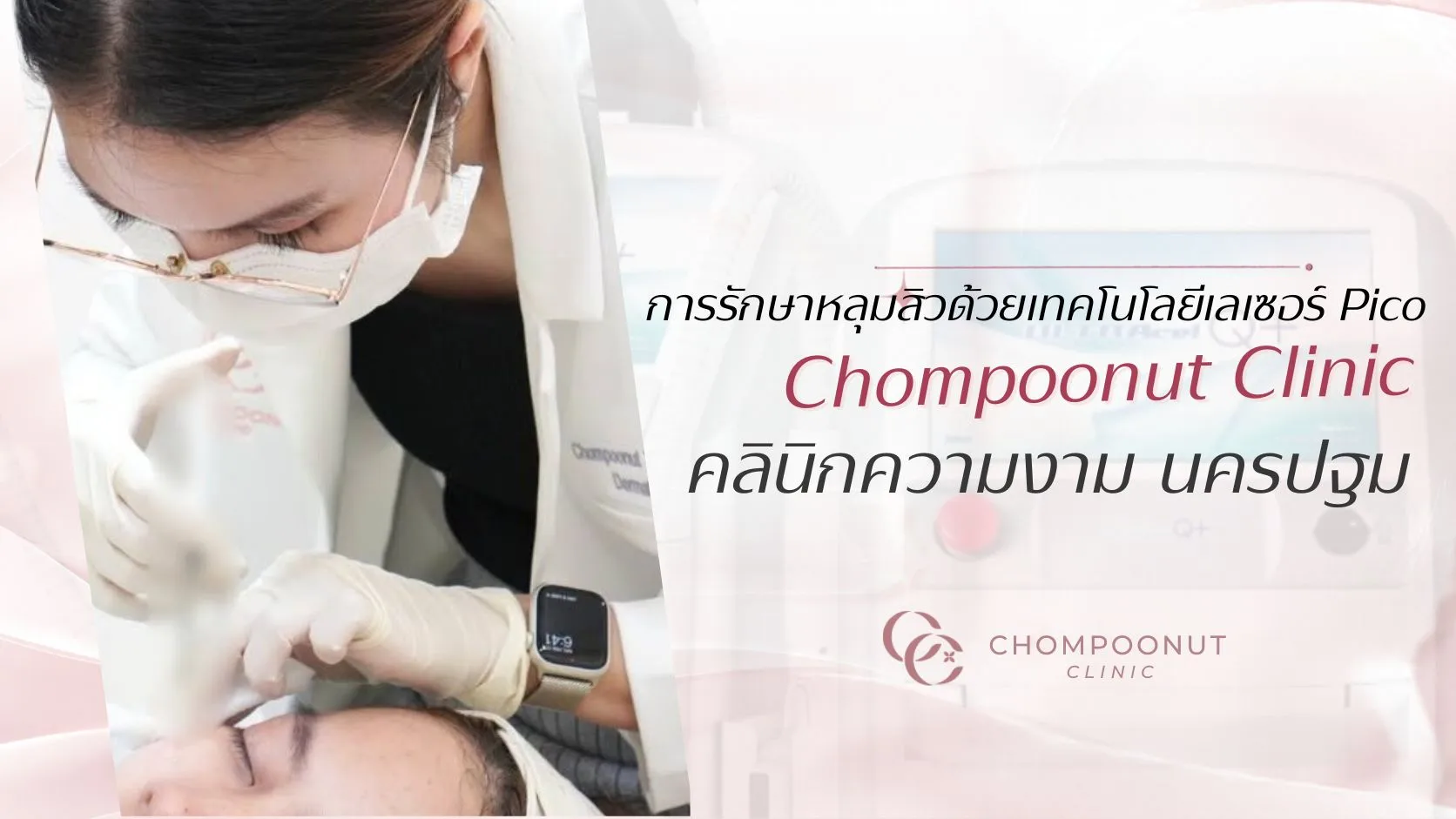 การรักษาหลุมสิวด้วยเทคโนโลยีเลเซอร์ Pico ที่ Chompoonut Clinic คลีนิคความงาม นครปฐม