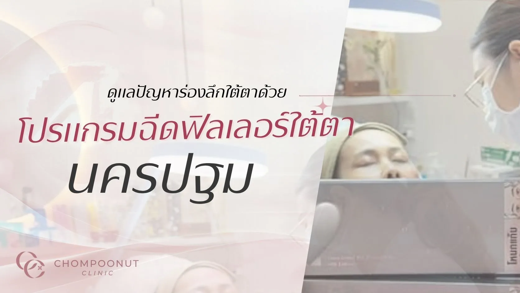 ดูแลปัญหาร่องลึกใต้ตาด้วยโปรแกรมฉีดฟิลเลอร์ใต้ตา (Filler) นครปฐม