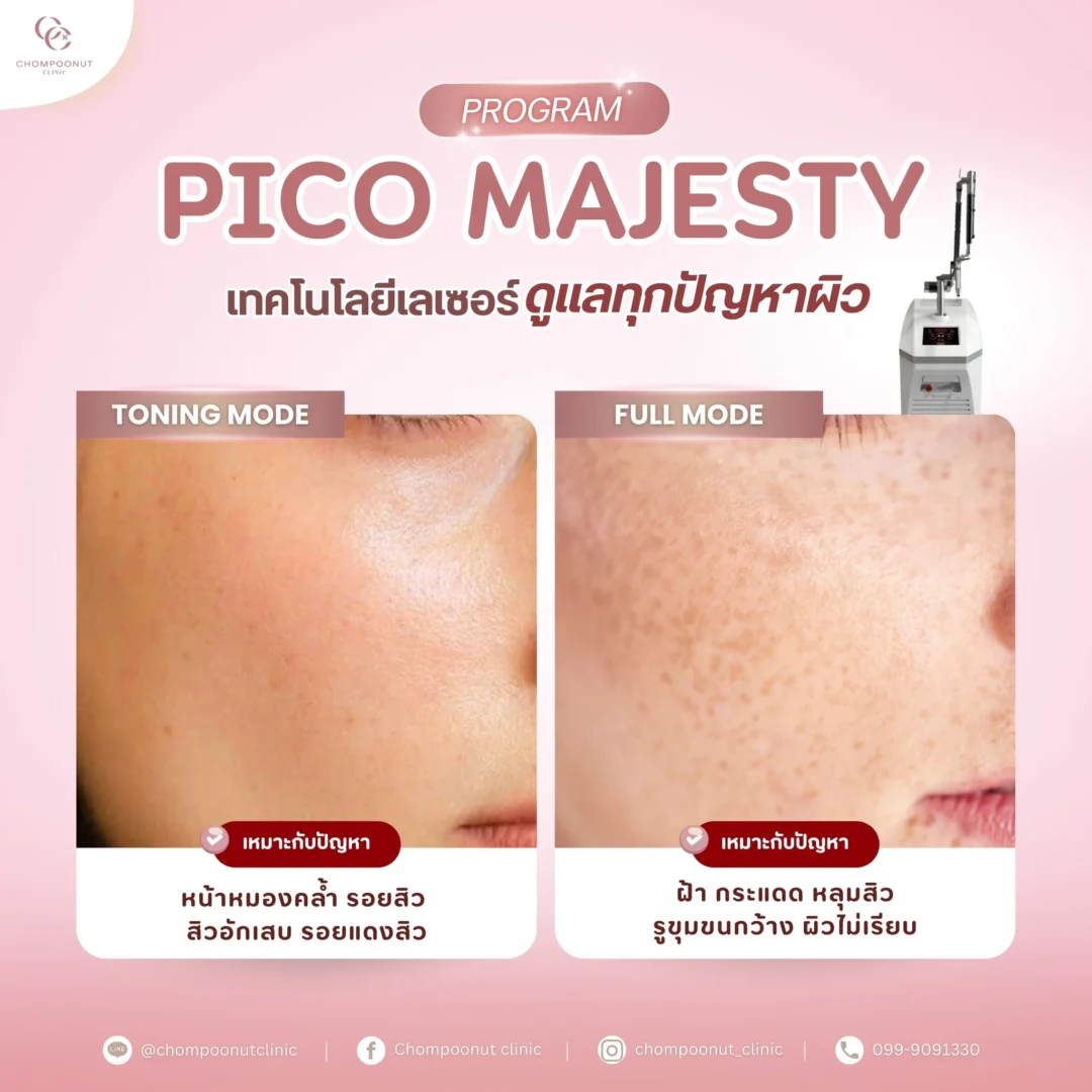 5 คำแนะนำดูแลปัญหาฝ้าแดด ฝ้าจากฮอร์โมน โปรแกรม Pico Majesty