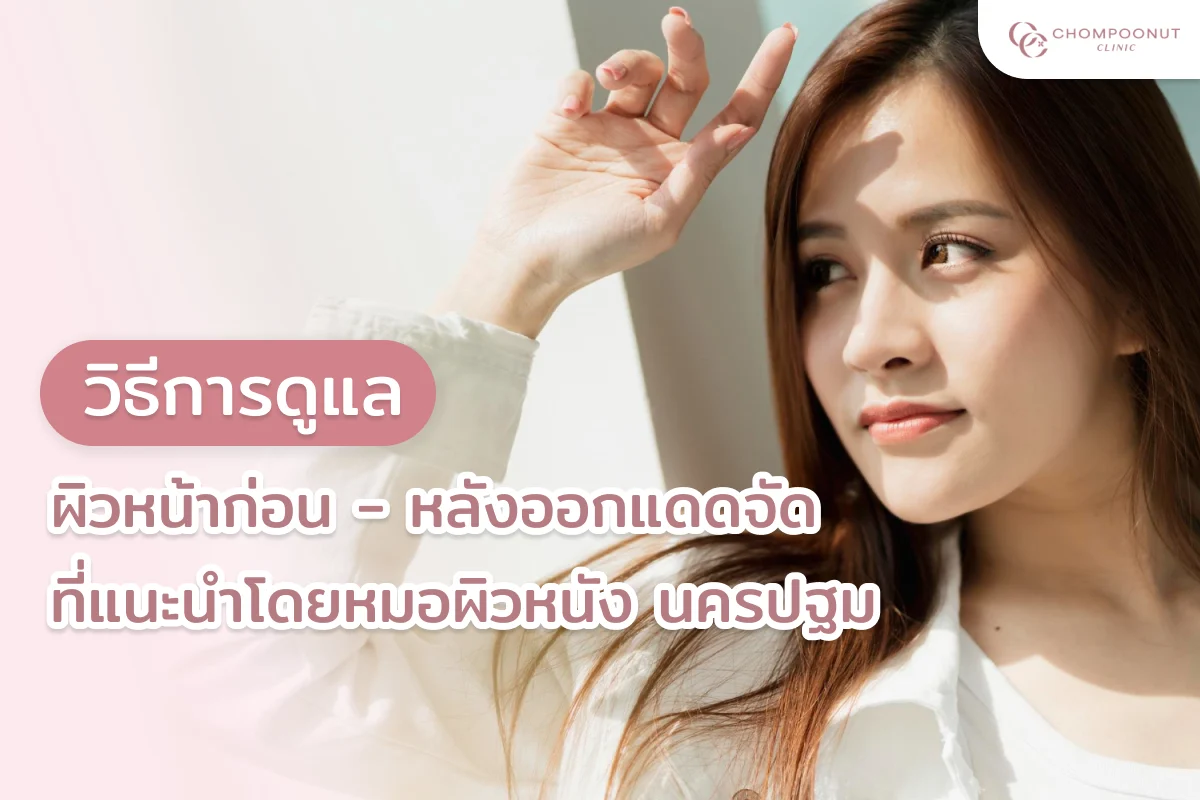 วิธีการดูแลผิวหน้าก่อน - หลังออกแดดจัด ที่แนะนำโดยหมอผิวหนัง นครปฐม