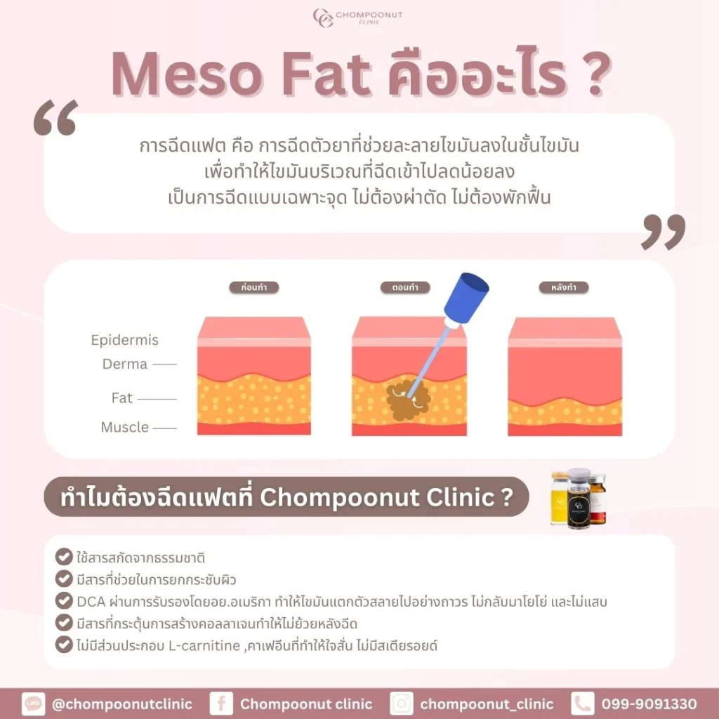 โปรแกรม Fat คืออะไร ? เหมาะกับใครบ้าง