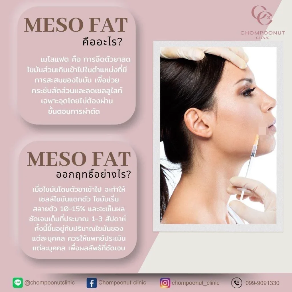 โปรแกรม MESO FAT คืออะไร? ออกฤทธิ์อย่างไร?