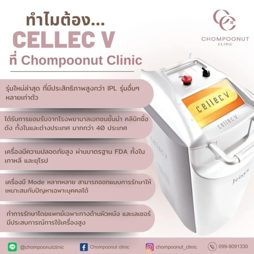 ทำไมต้อง Cellec v ที่ Chompoonutclinic