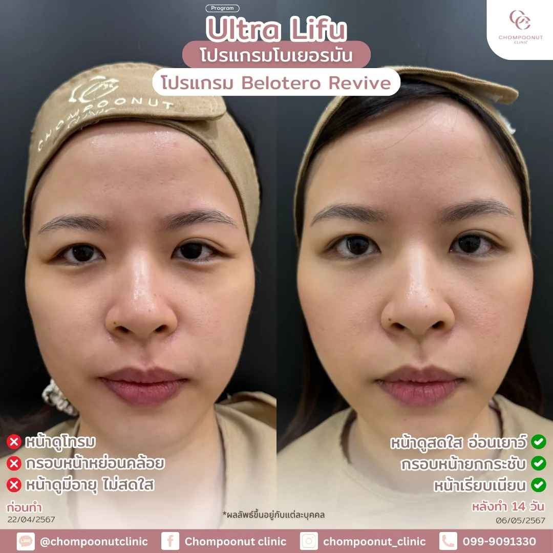 รีวิวที่จริงใจ โปรแกรม Lifu ทำหน้า นครปฐม