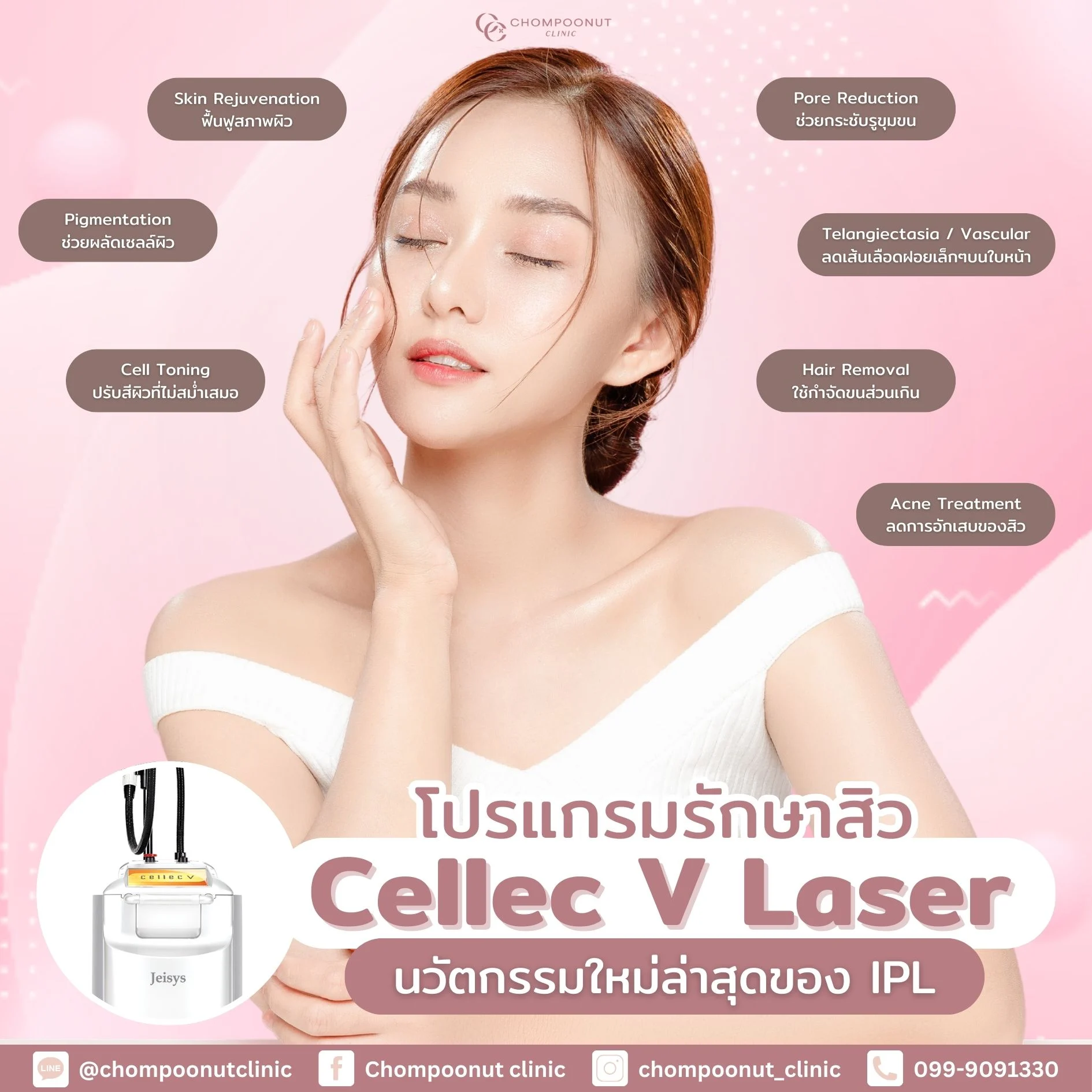โปรแกรม Cellec V คืออะไร? รักษาปัญหาสิว ฝ้า และรอยดำ เหมาะกับใครบ้าง