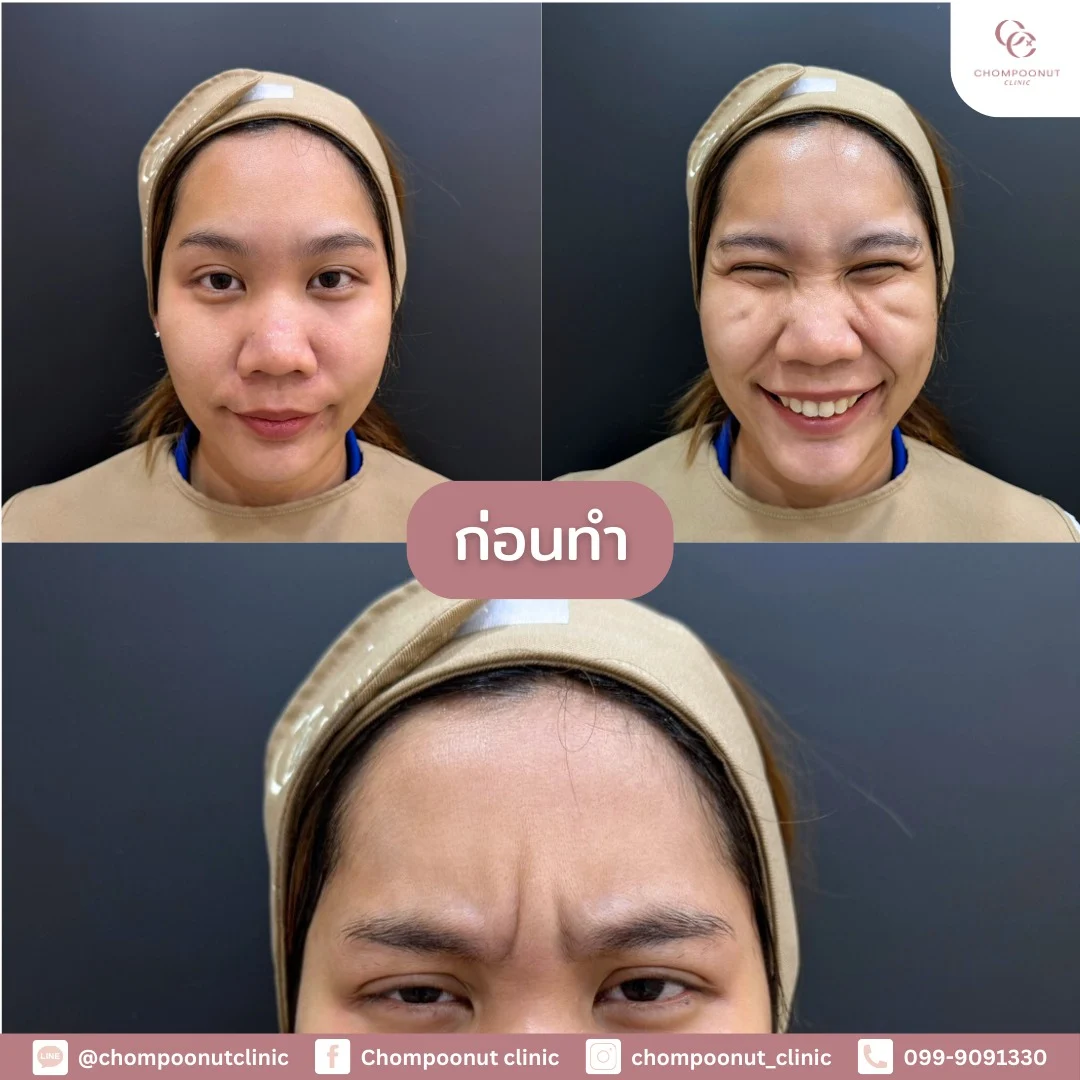 รีวิวที่จริงใจ โปรแกรม Lifu ทำหน้า นครปฐม