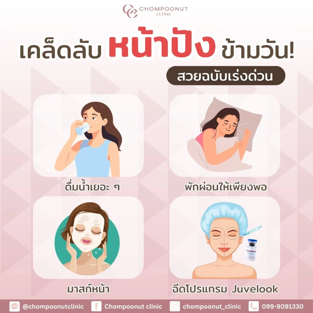 เคล็ดลับหน้าปังข้ามวัน! สวยฉบับเร่งด่วนกับ Chompoonut Clinic