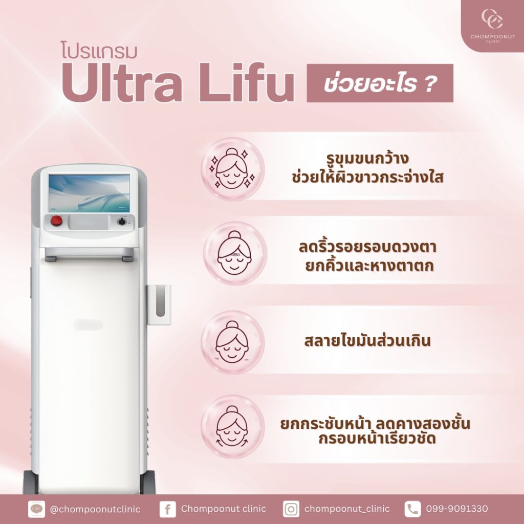 โปรแกรม Lifu ช่วยเรื่องอะไรบ้าง ?​