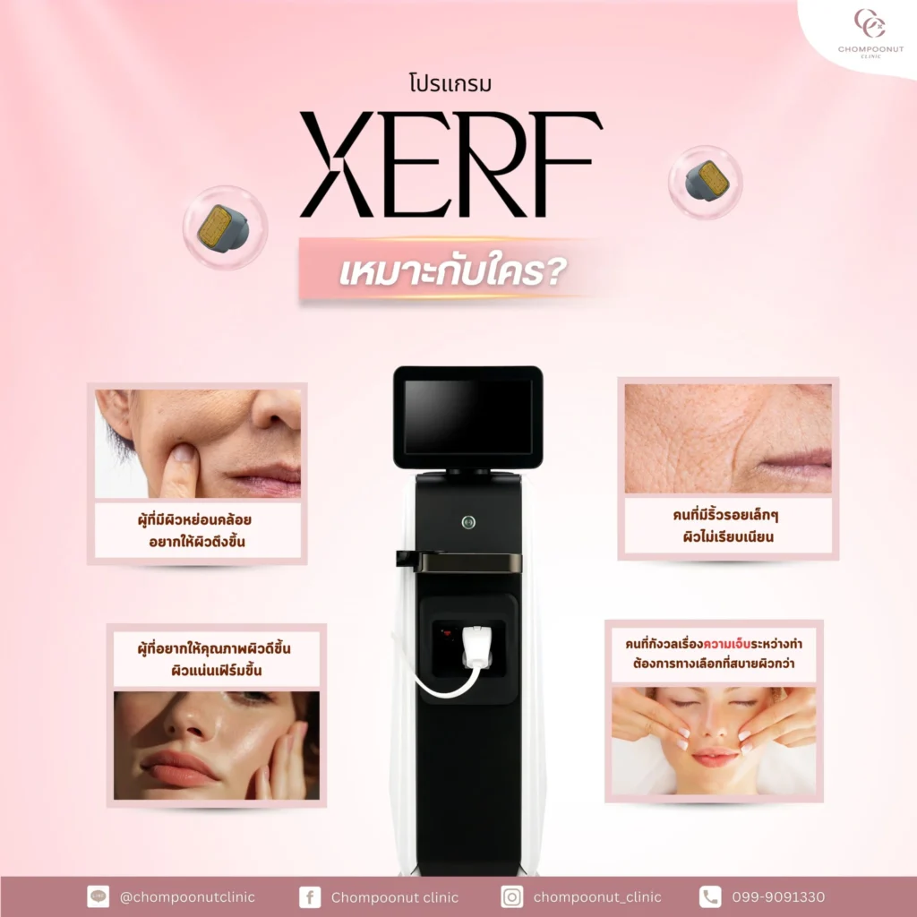 โปรแกรม XERF คืออะไร ? เหมาะกับใครบ้าง