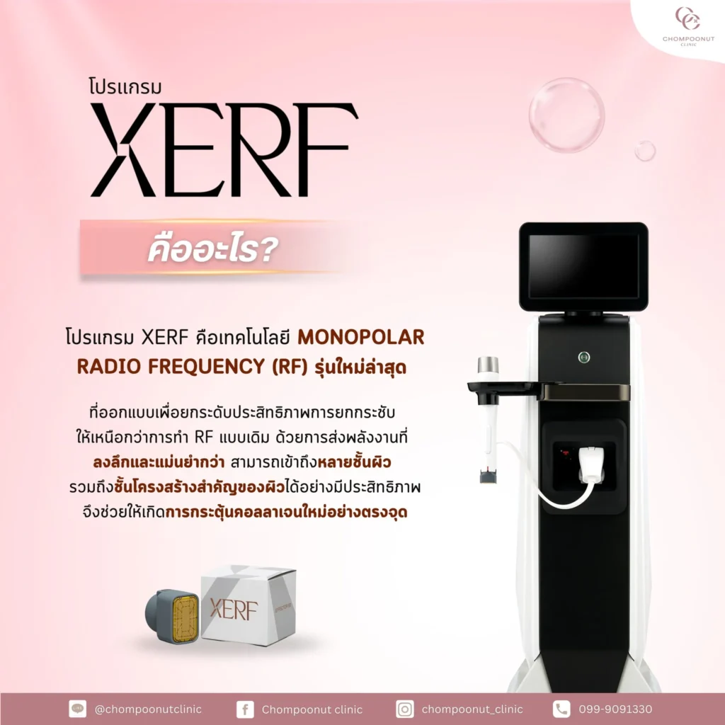 โปรแกรม XERF นวัตกรรมยกกระชับผิวที่ Chompoonut Clinic นครปฐม