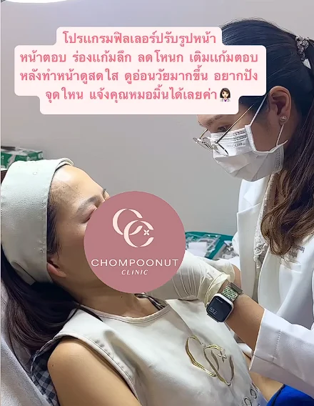 Program Filler คืออะไร เหมาะกับใครบ้าง ?