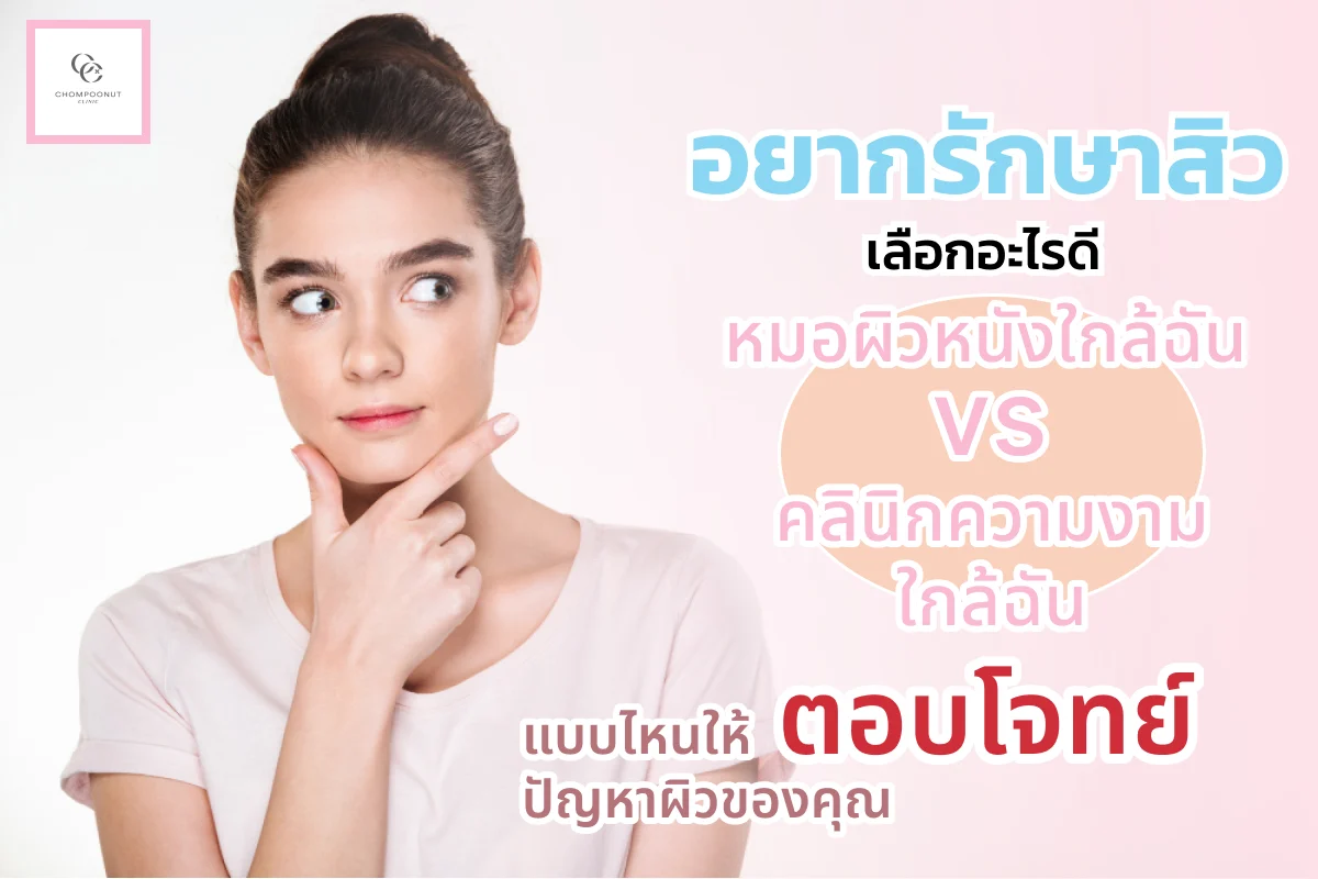 อยากรักษาสิว เลือกอะไรดี ระหว่าง หมอผิวหนังใกล้ฉัน vs คลินิกความงาม ใกล้ฉัน แบบไหนให้ตอบโจทย์ปัญหาผิวของคุณ