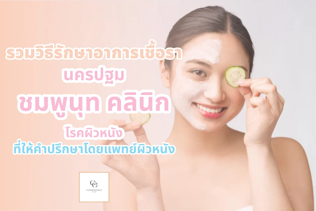 รวมวิธีรักษาอาการเชื้อรา นครปฐม ที่ชมพูนุท คลินิก โรคผิวหนัง ที่ให้คำปรึกษาโดยแพทย์ผิวหนัง