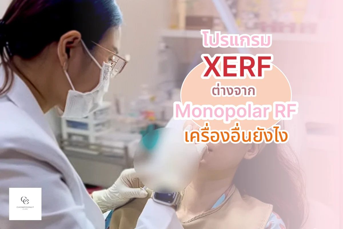 โปรแกรม XERF ต่างจาก Monopolar RF เครื่องอื่นยังไง?