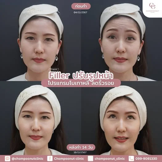Program Filler ปรับรูปหน้า