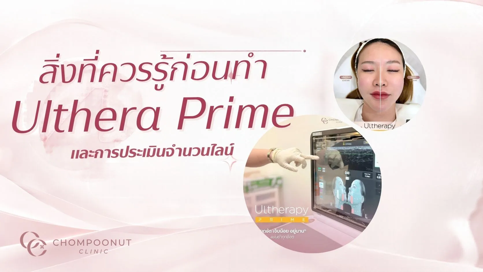 โปรแกรม Ulthera Prime ราคา