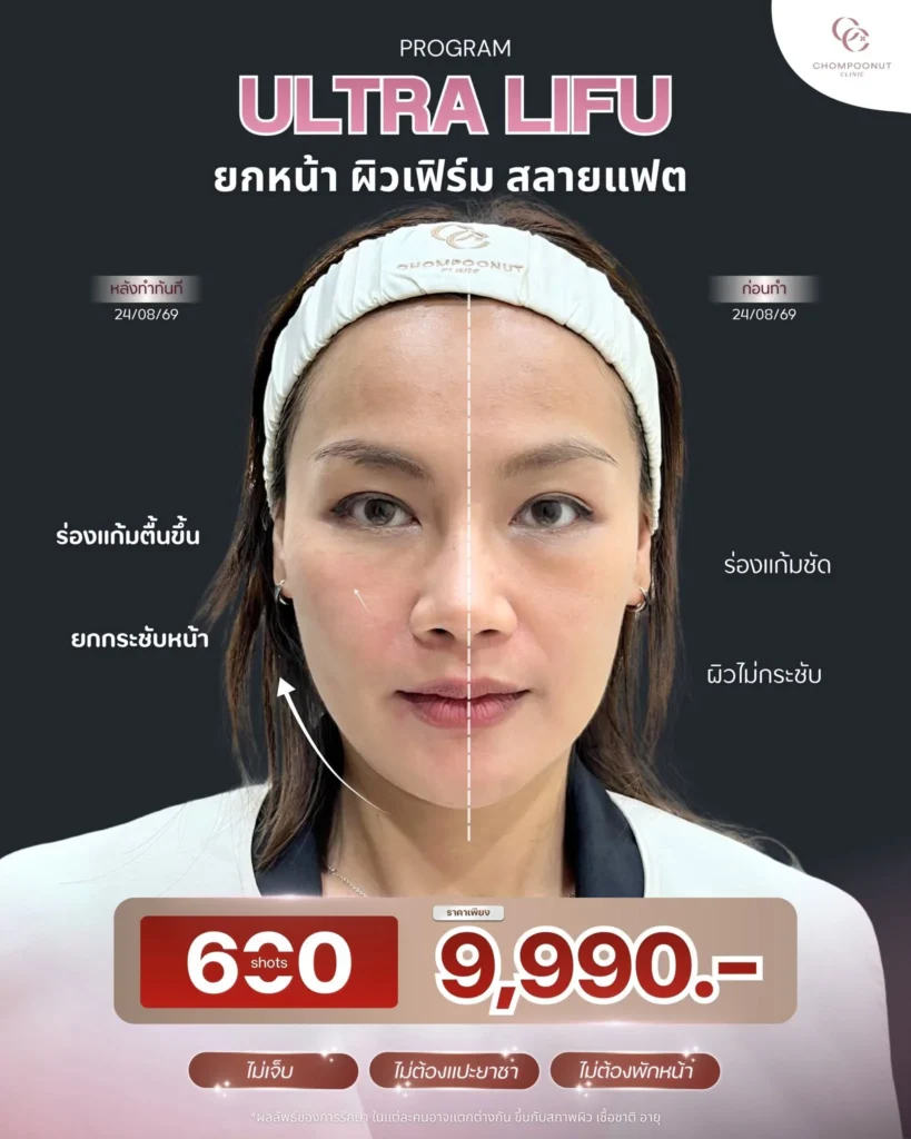 Ultra Lifu 600 SHOTS