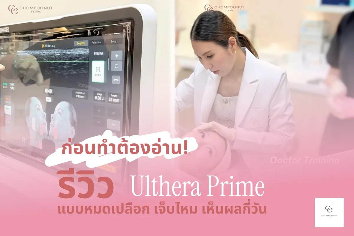 สำหรับชาวนครปฐม ก่อนทำต้องอ่าน! รีวิว Ulthera Prime แบบหมดเปลือก เจ็บไหม เห็นผลกี่วัน
