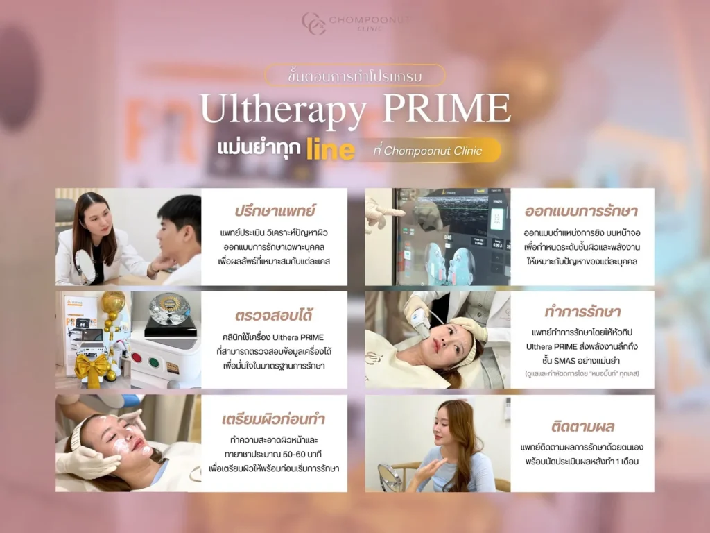 Ulthera Prime นครปฐม