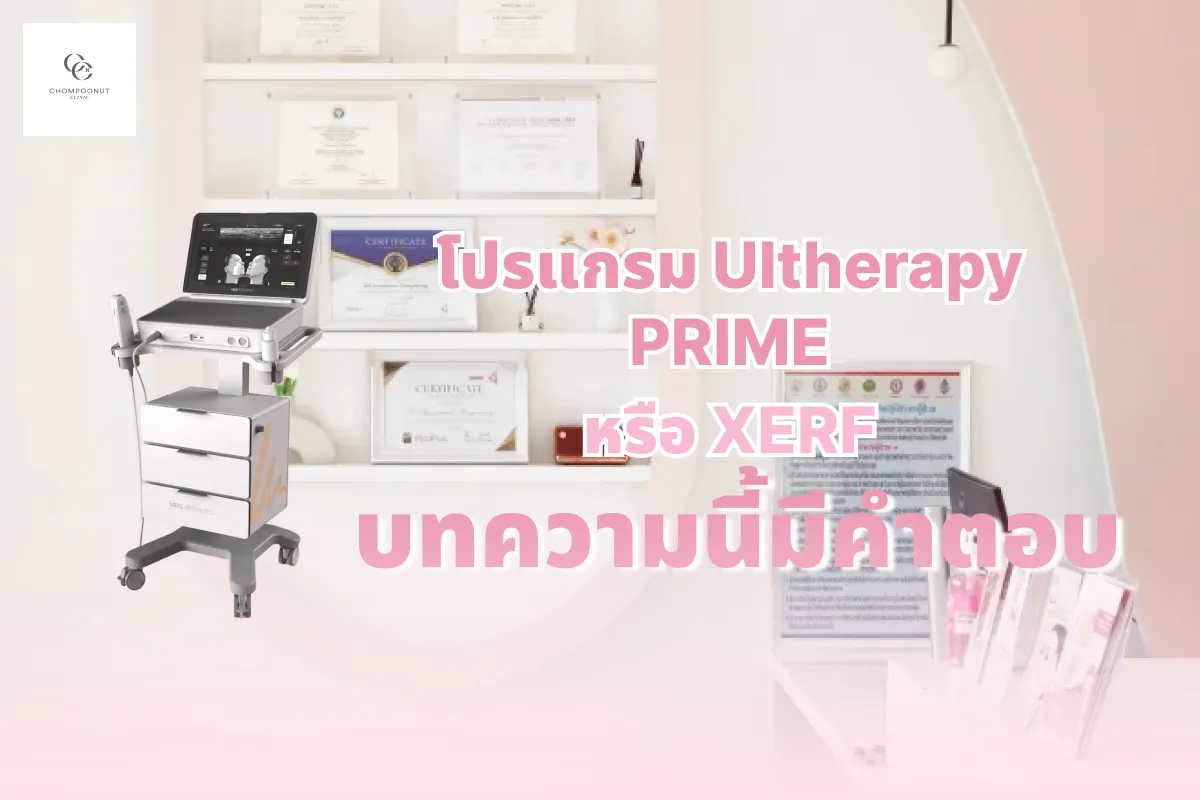 Ultherapy PRIME หรือ XERF