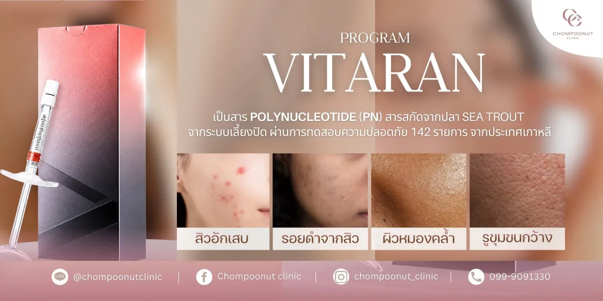 โปรแกรม Vitaran
