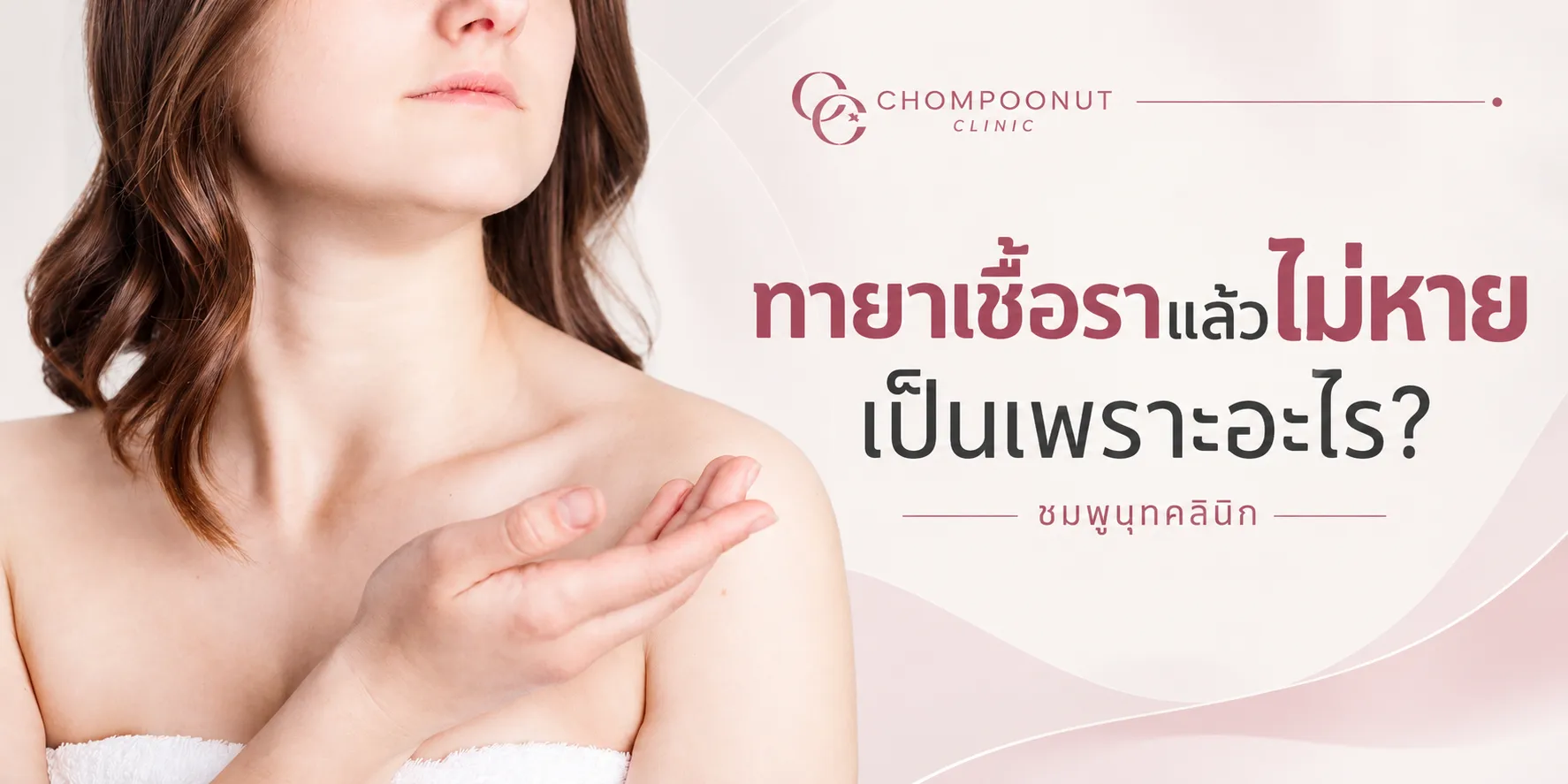 ทายาเชื้อราแล้วไม่หาย เป็นเพราะอะไร? อาจไม่ใช่เชื้อราเสมอไป