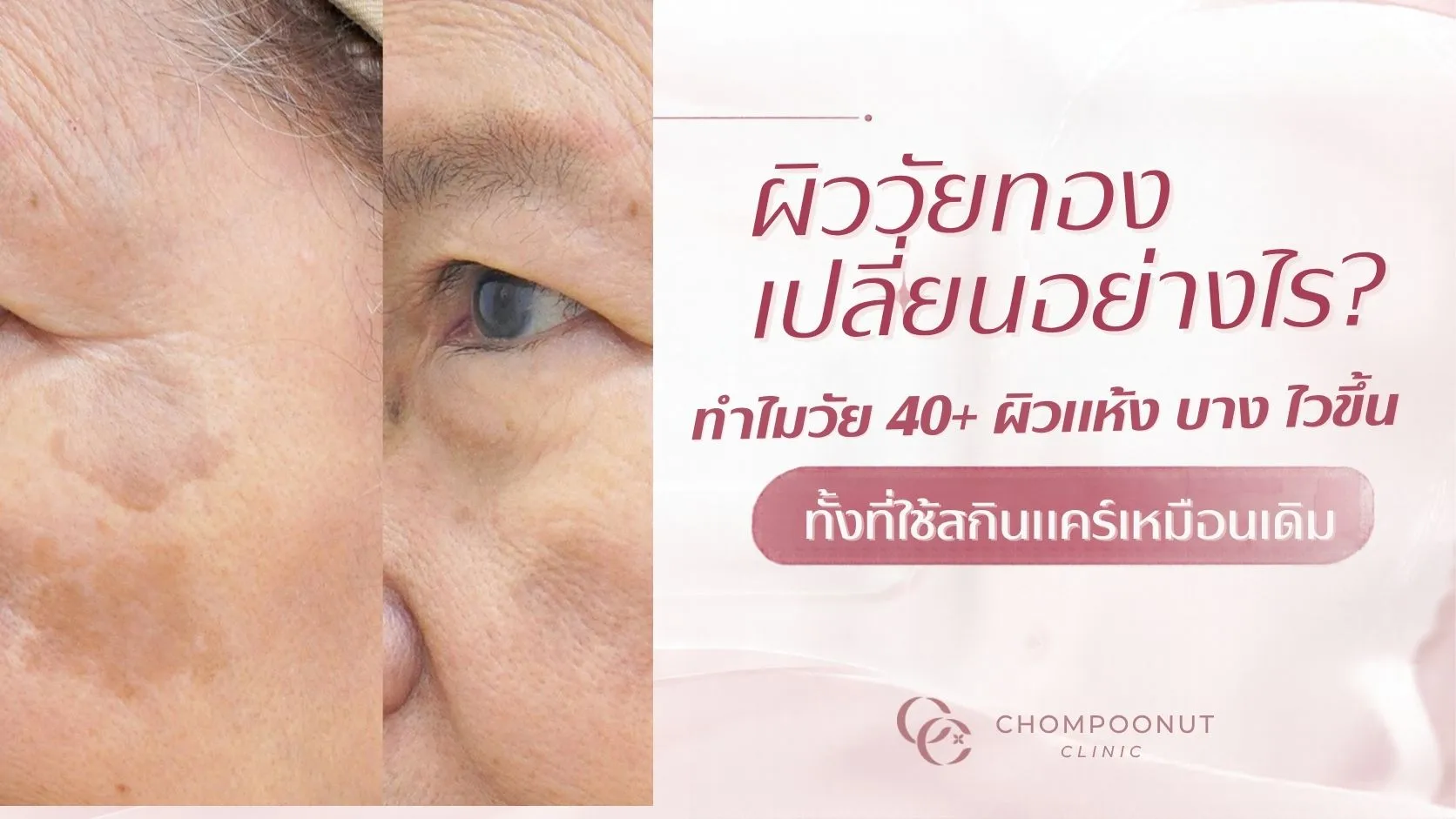 ผิววัยทองเปลี่ยนอย่างไร? ทำไมวัย 40+ ผิวแห้ง บาง และระคายเคืองง่ายขึ้น